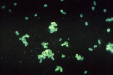 Col28a1 3'UTR Lenti-reporter-GFP Virus